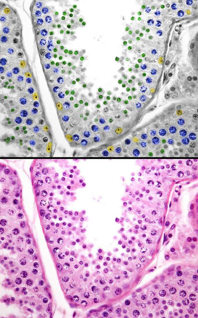 Spermatogenesis in human testicle, light micrographs