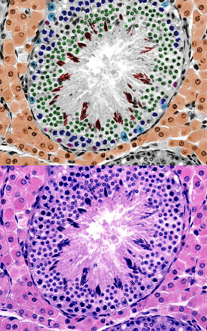 Seminiferous tubule and Leydig cells, light micrographs