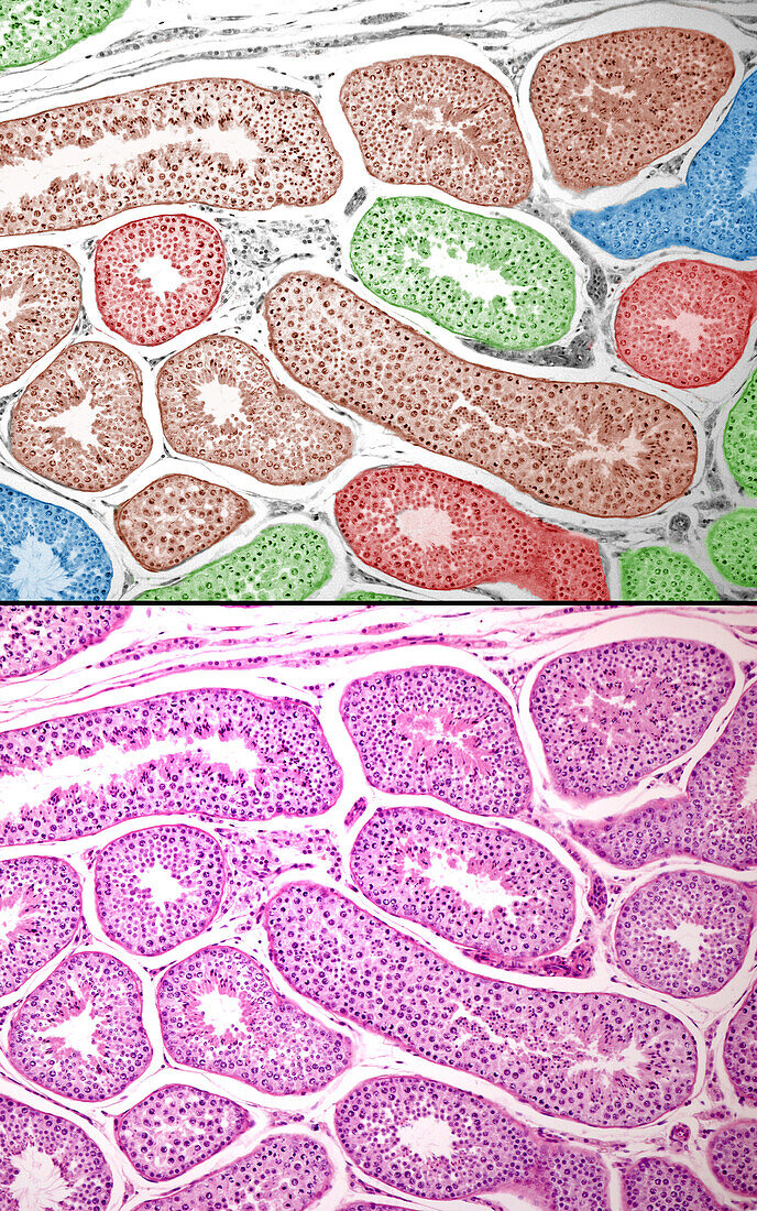 Human seminiferous tubules, light micrographs