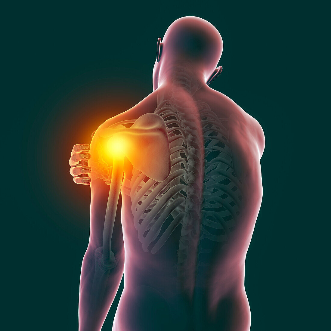 Painful shoulder, illustration