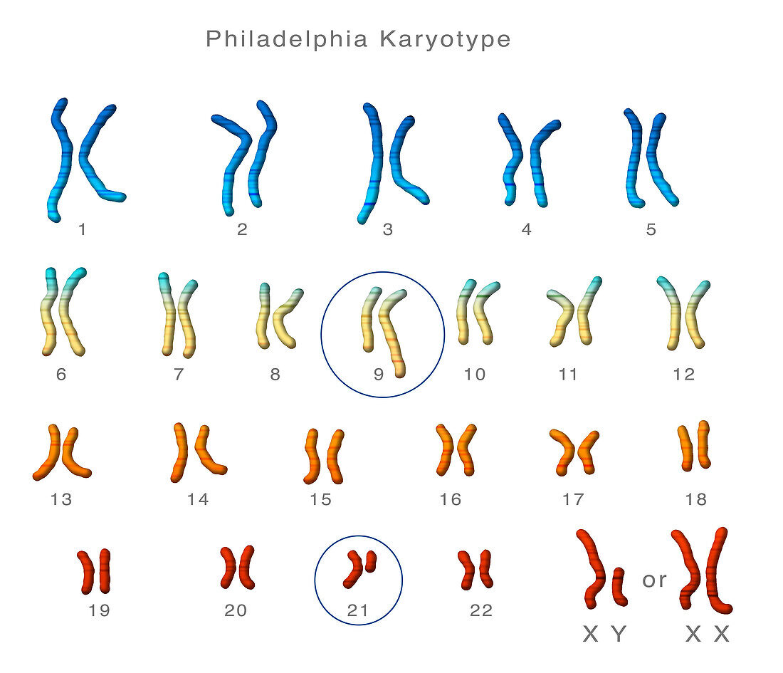 Philadelphia chromosome, illustration