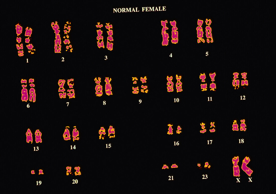 Normal female karyotype, illustration