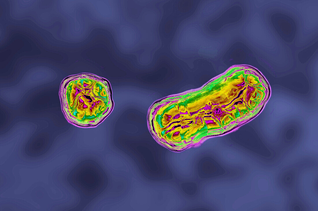 Hepatitis B virus, TEM