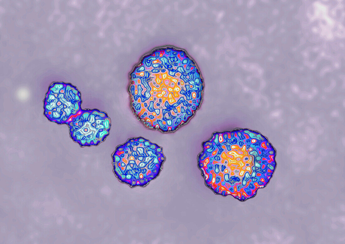 Hepatitis C virus, TEM