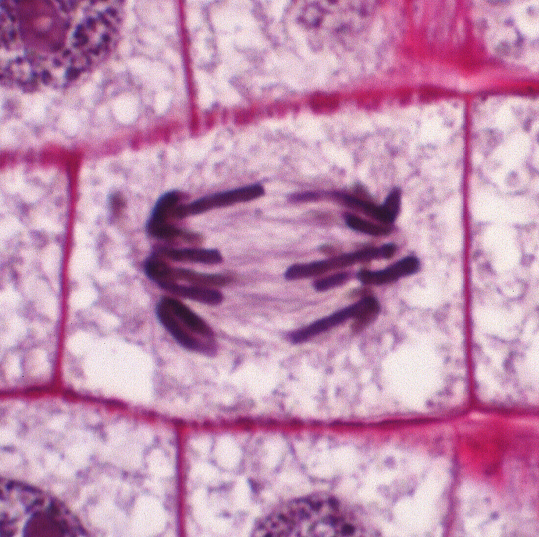 Anaphase in onion root tip cell, light micrograph