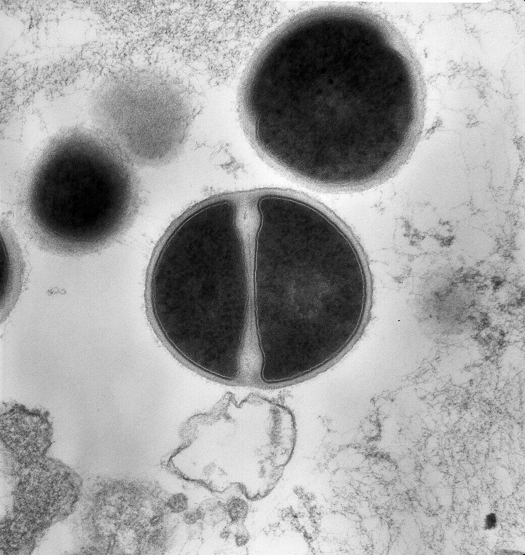 Staphylococcus aureus, TEM