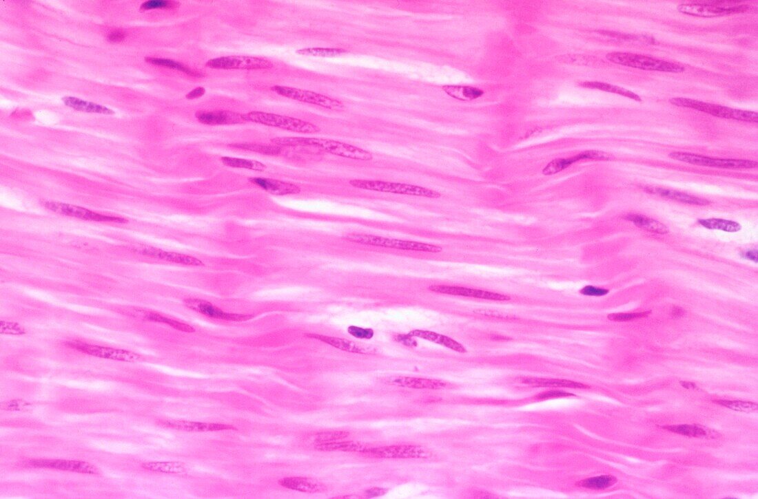 Smooth muscle cells, light micrograph, light micrograph