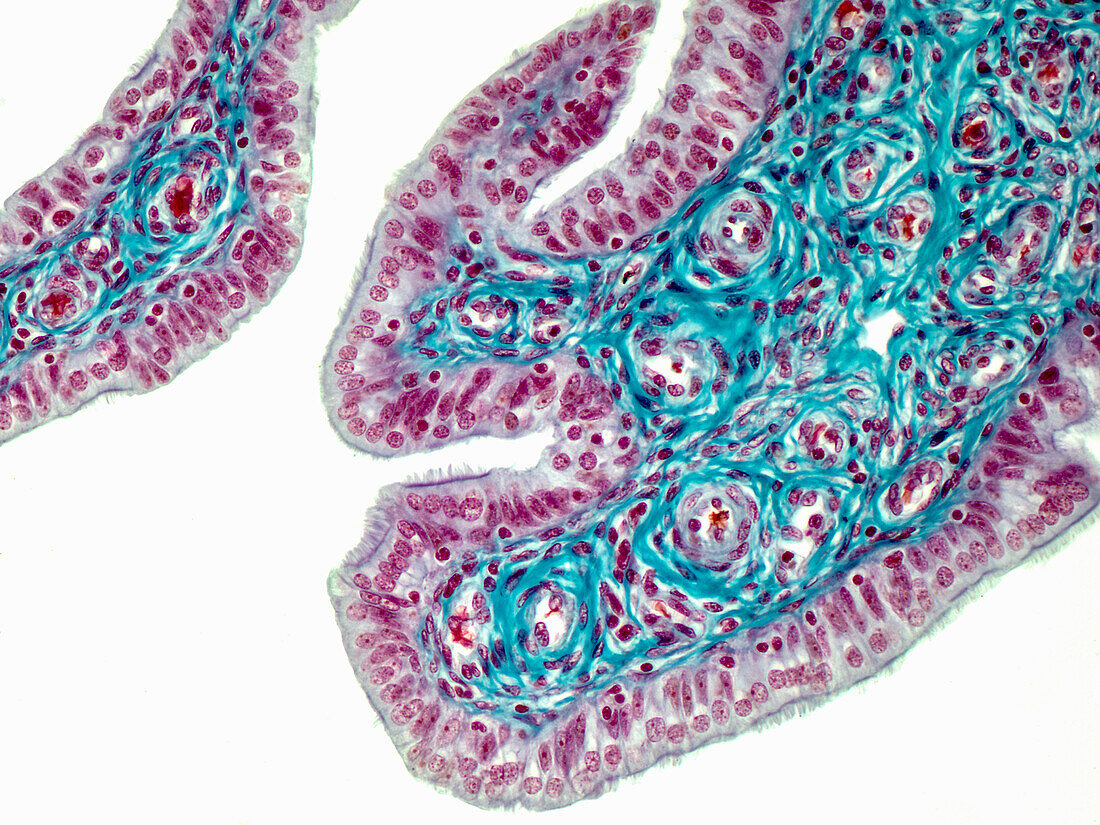 Human oviduct, light micrograph