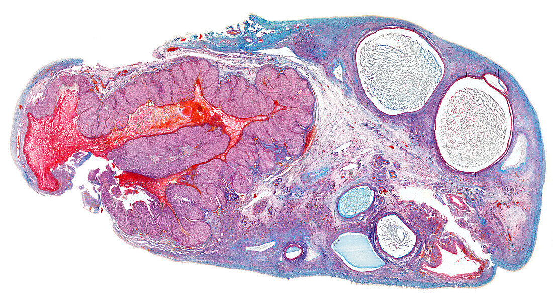 Rabbit corpus hemorrhagicum, light micrograph