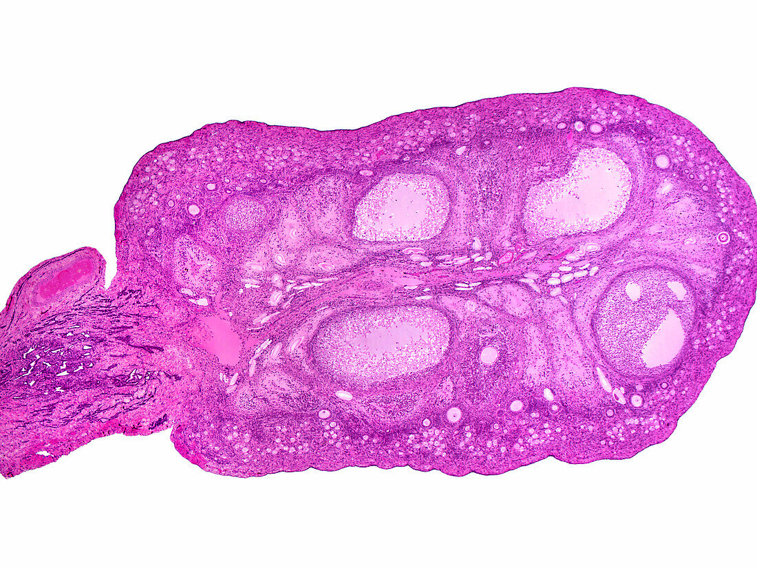 Monkey ovary, light micrograph