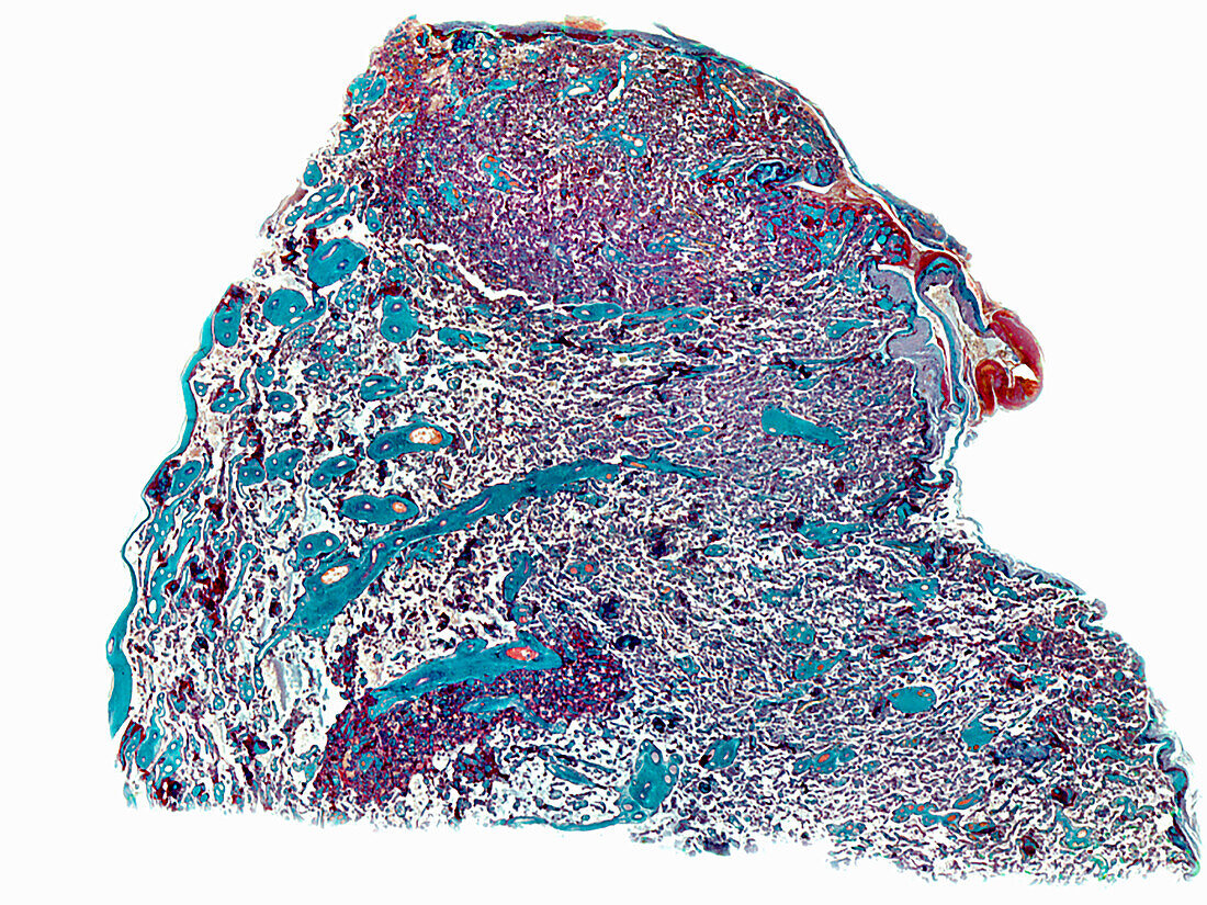 Human placenta, light micrograph