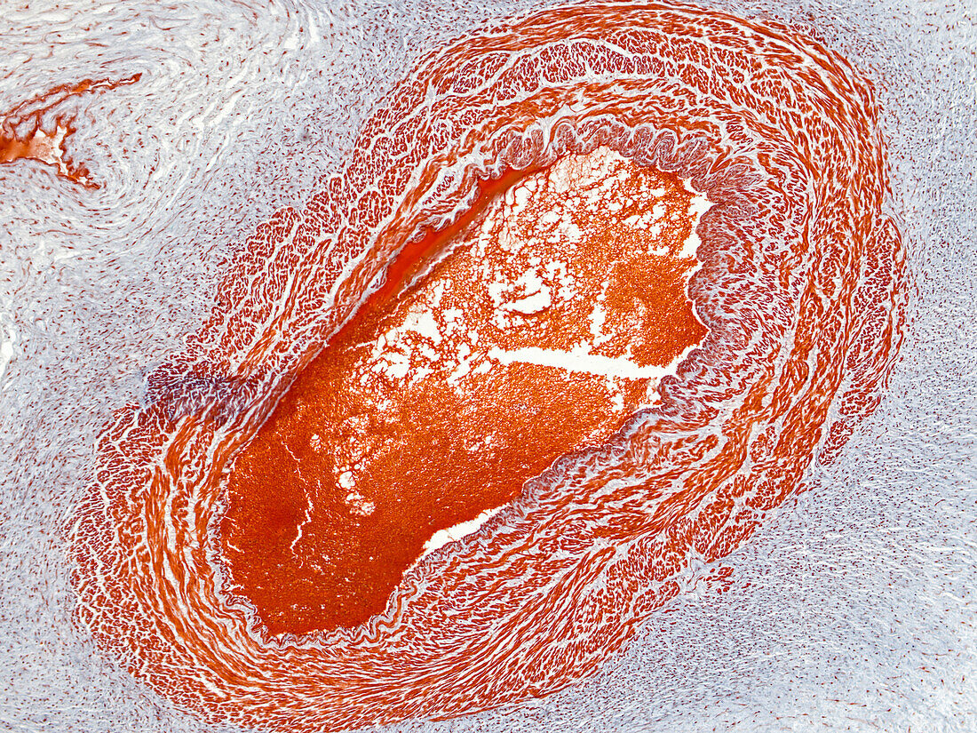 Human umbilical cord, light micrograph