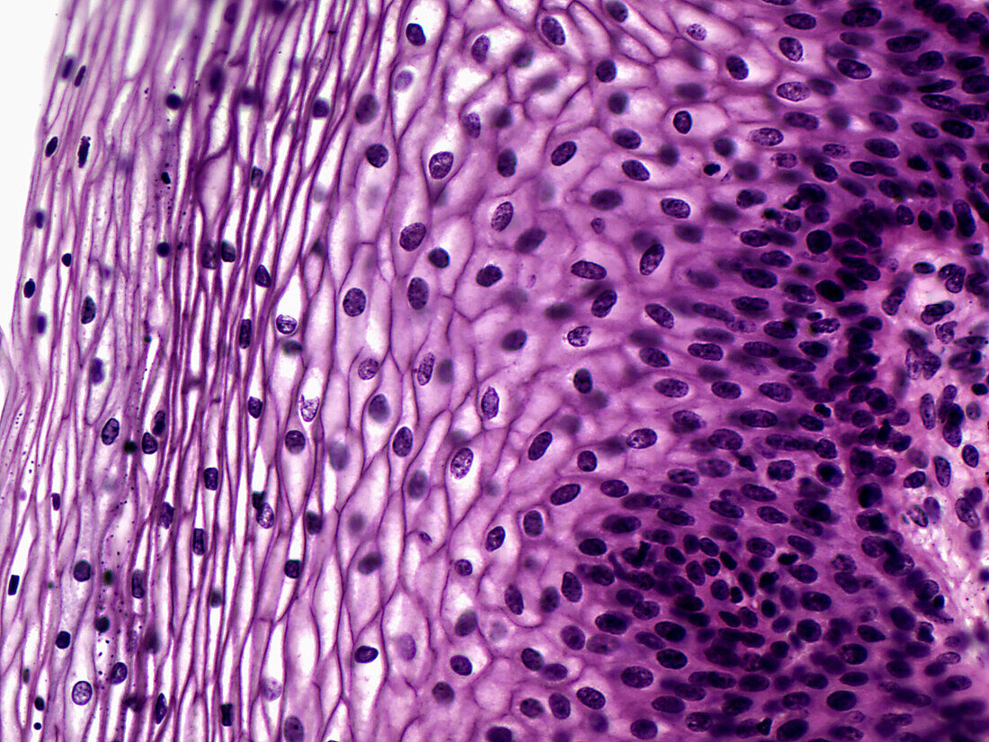 Human vagina, light micrograph
