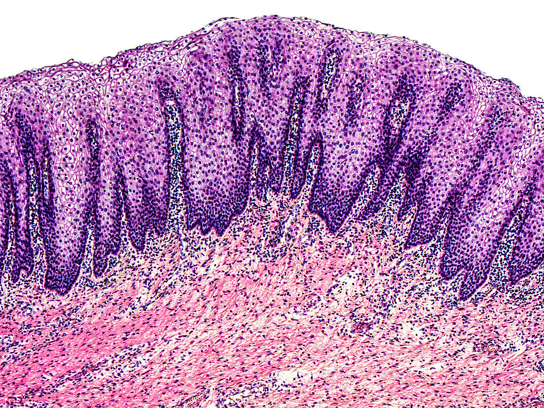 Human vagina, light micrograph