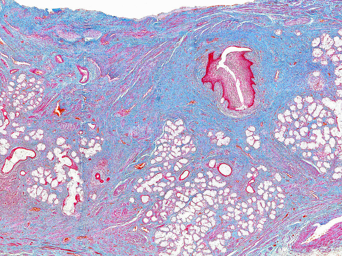 human-bartholin-s-gland-light-acheter-une-photo-13619784-science