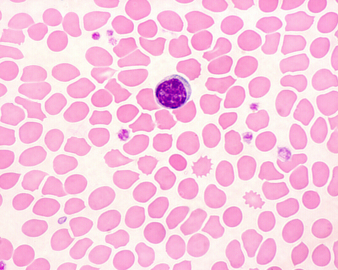 Human blood smear with lymphocyte, light micrograph