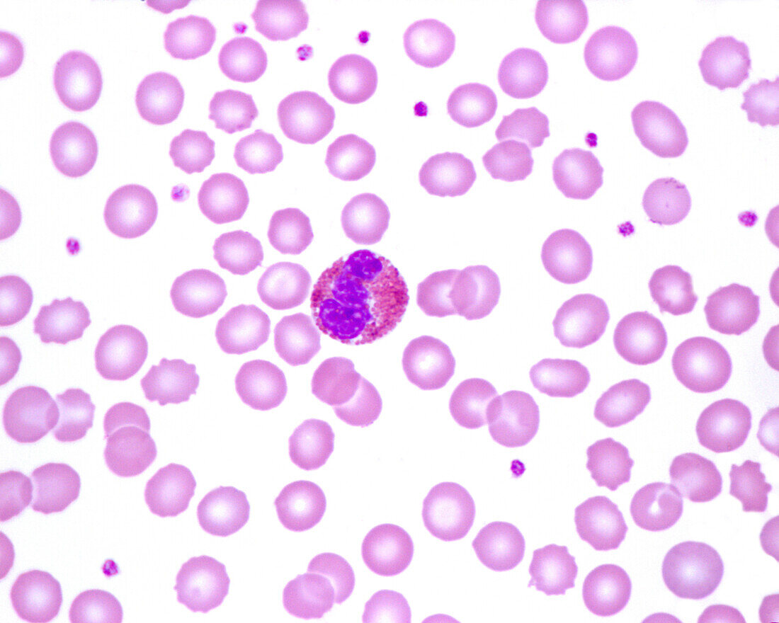 Human blood smear with eosinophil, light micrograph
