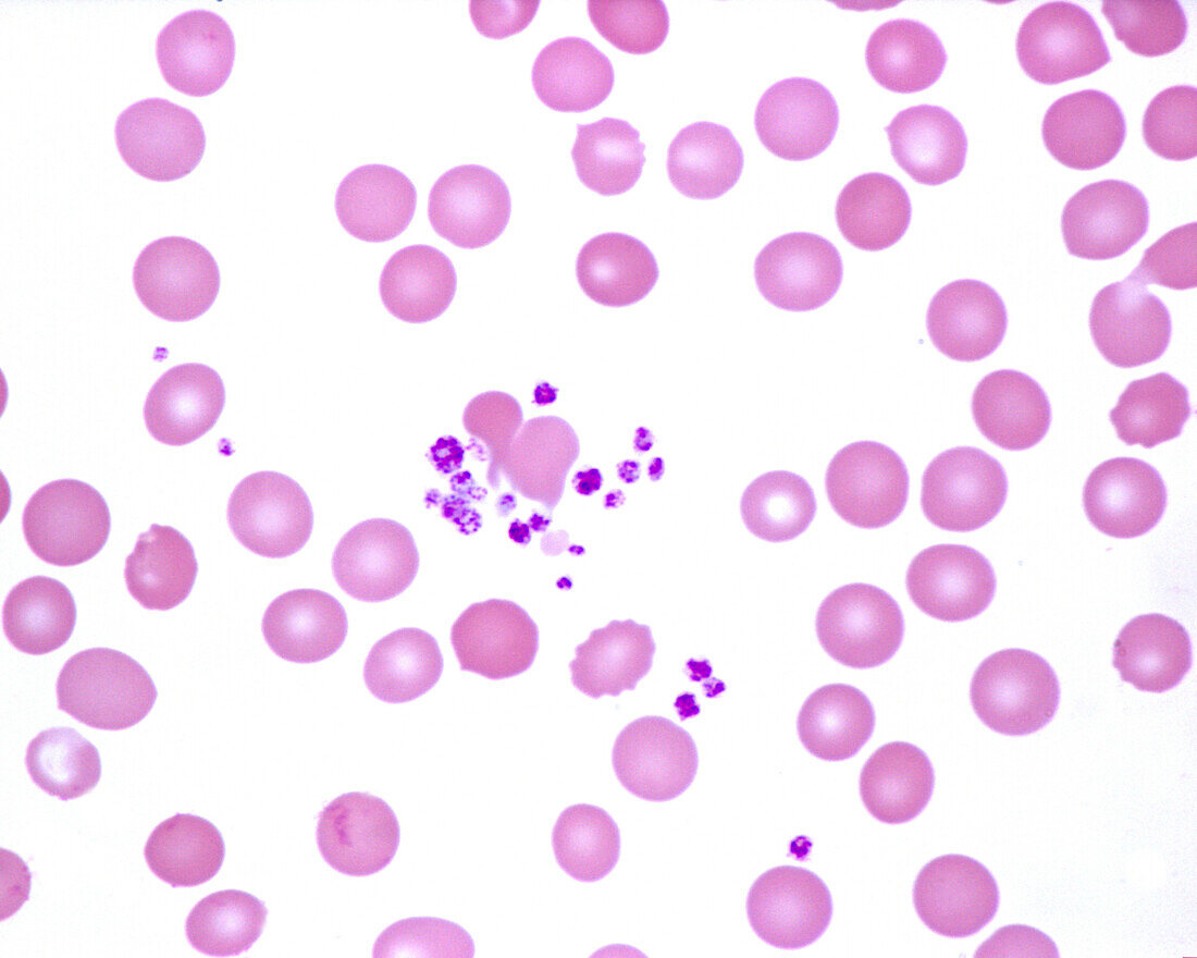 Human blood smear with platelets, light micrograph