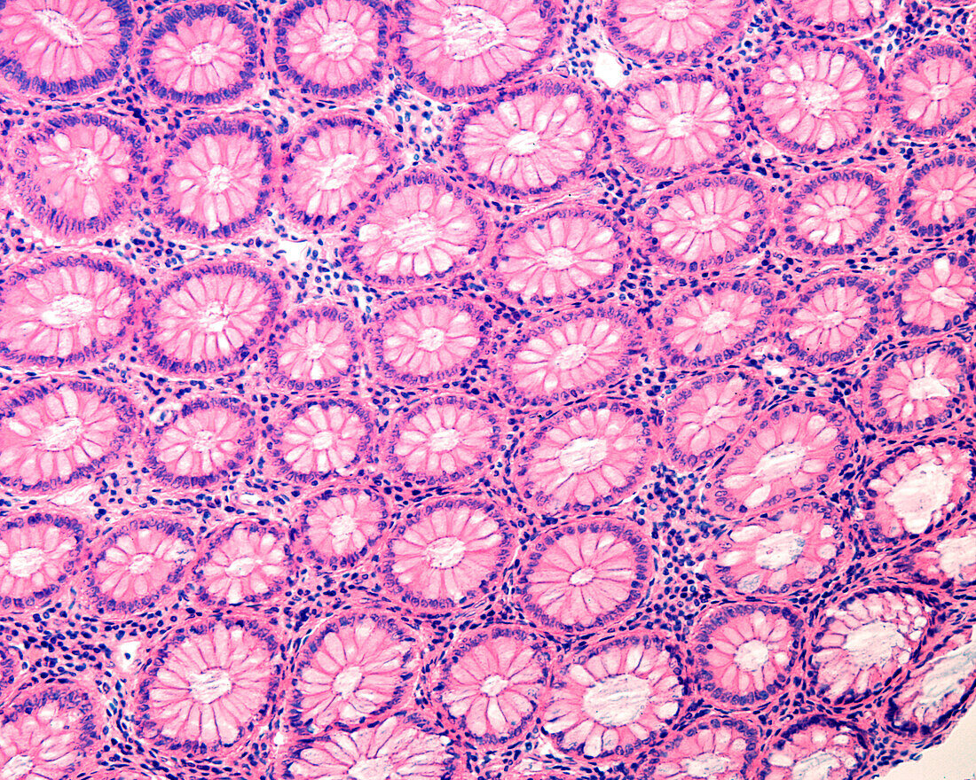 Mucosal crypts in human colon, light micrograph