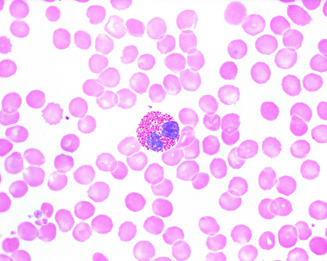 Human blood smear with eosinophil, light micrograph