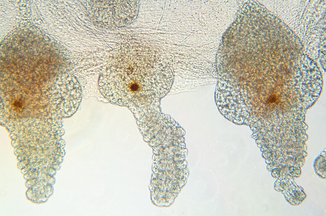 Stinging appendages on juvenile jellyfish, UK