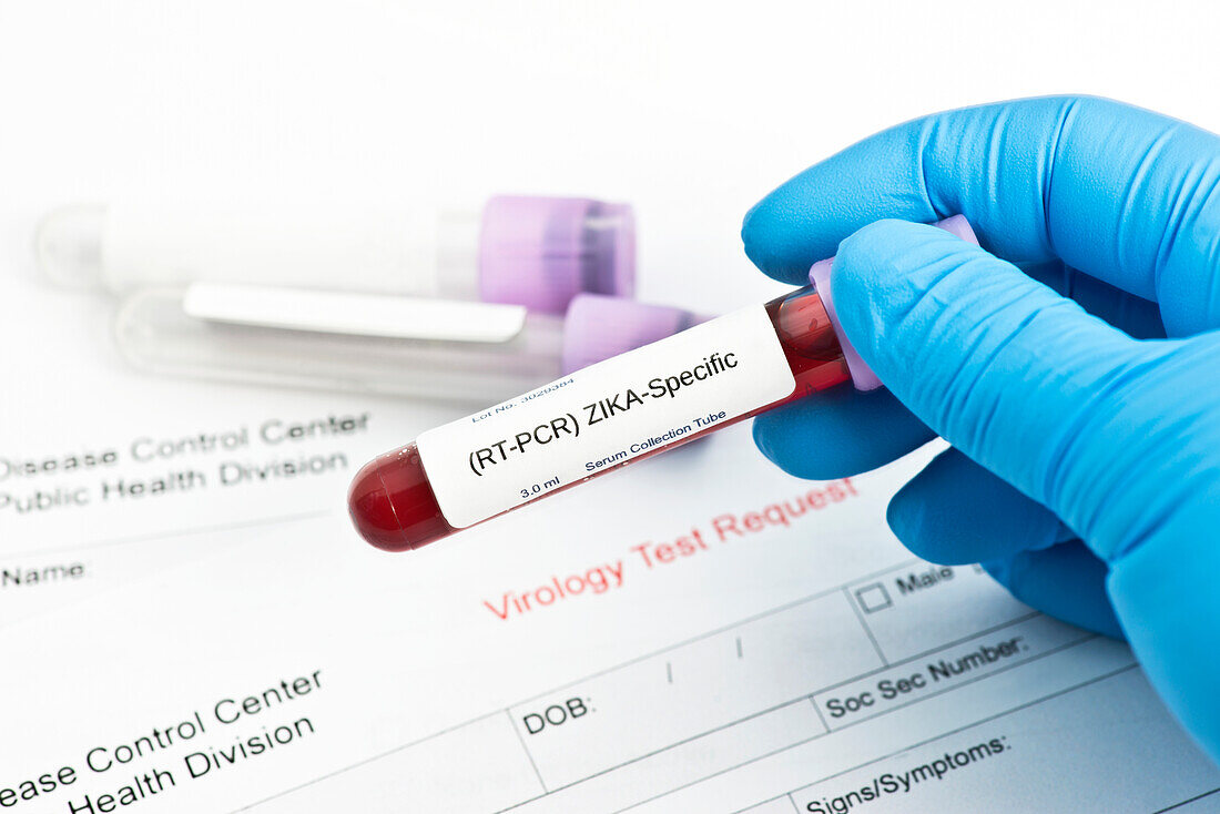 Zika virus lab test