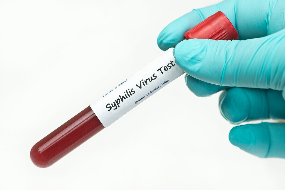 Syphilis test panel