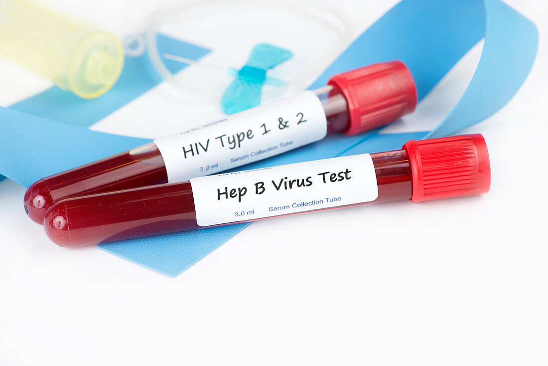 HIV and hepatitis