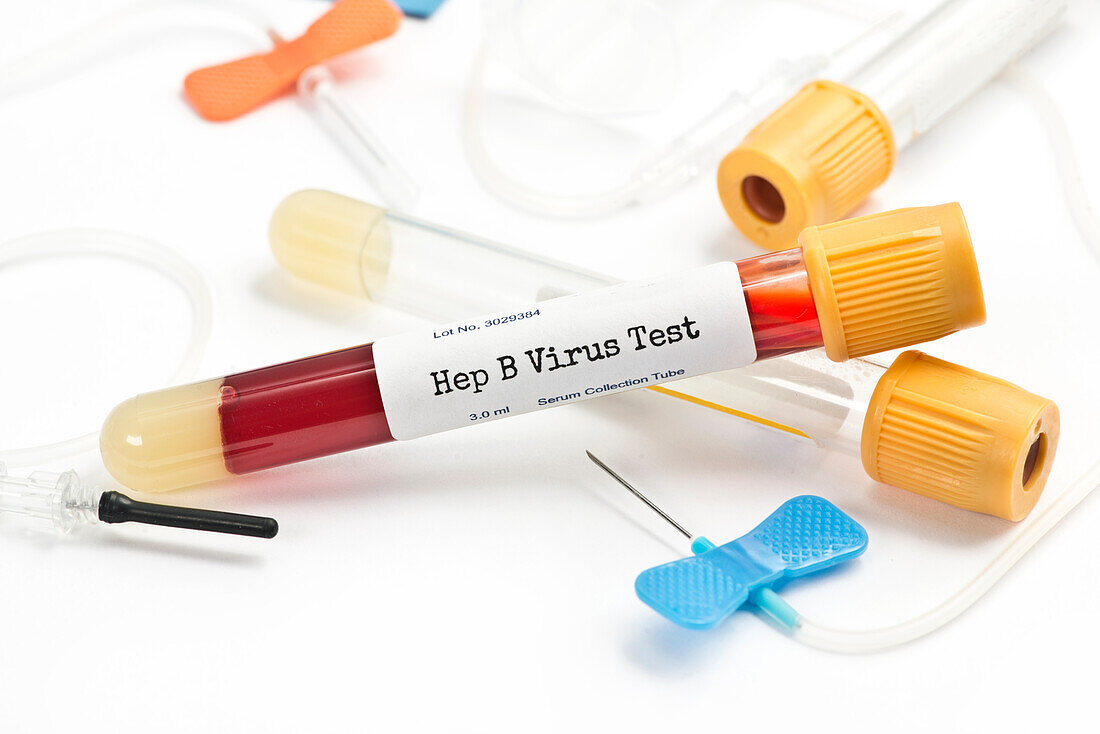 Hepatitis test