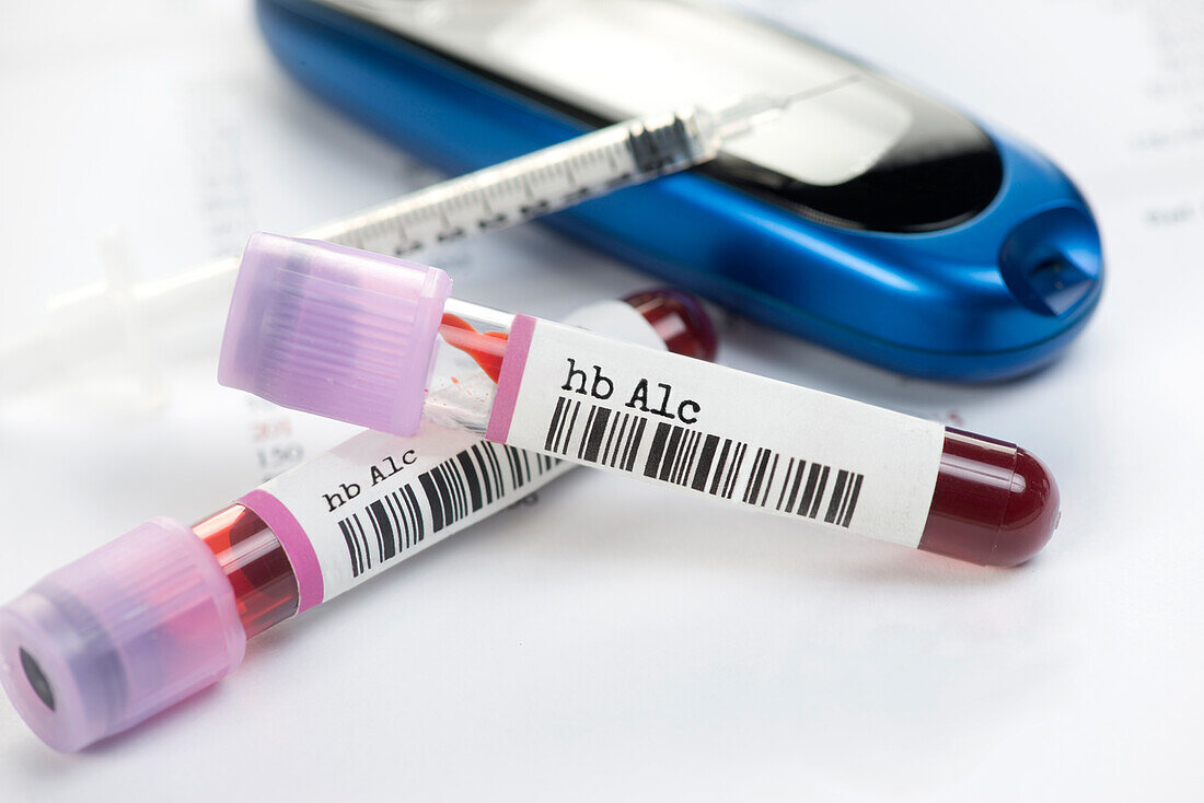 hBA1c blood test tubes