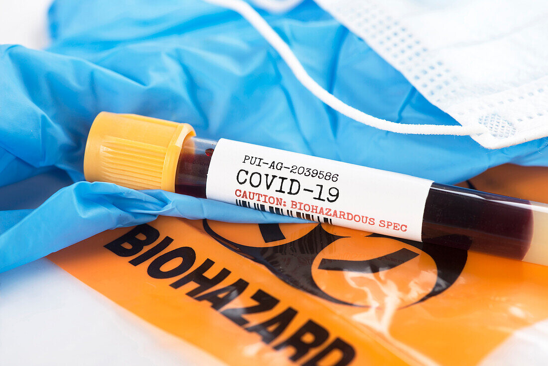 Coronavirus covid-19 virus blood test