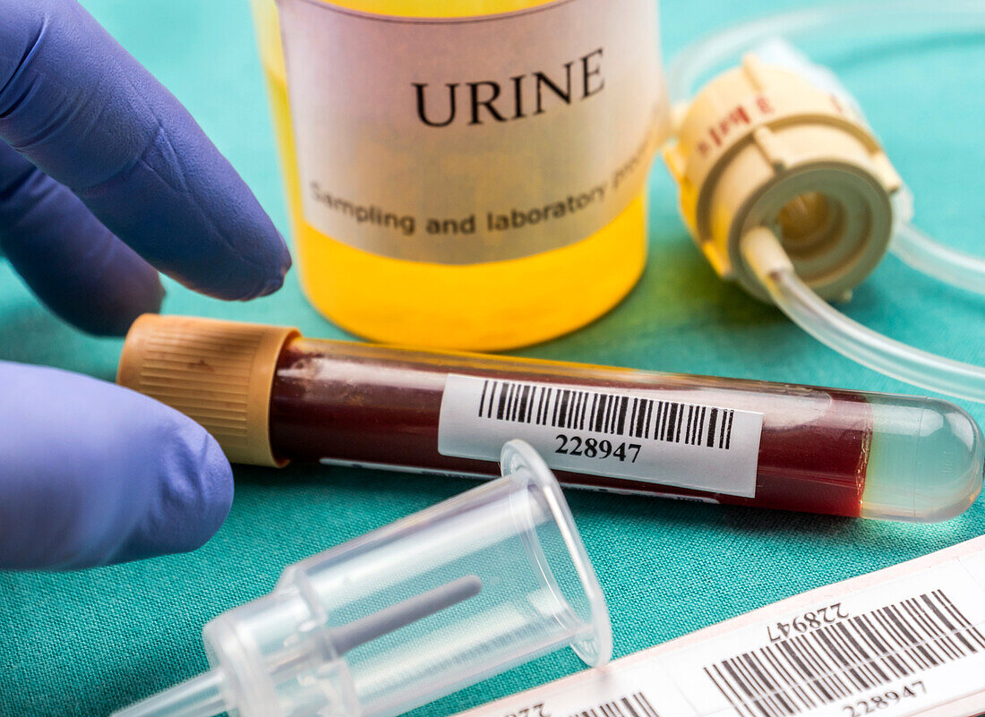 Blood sample at a hospital table, conceptual image