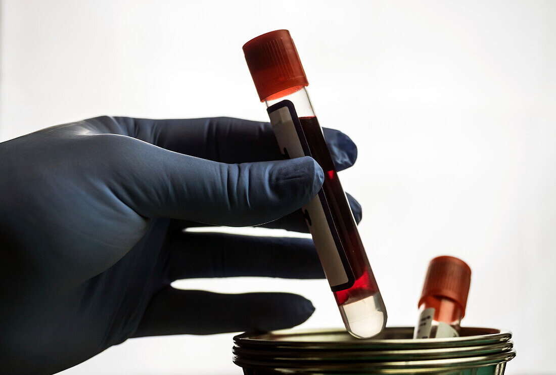 Doctor holding a blood sample