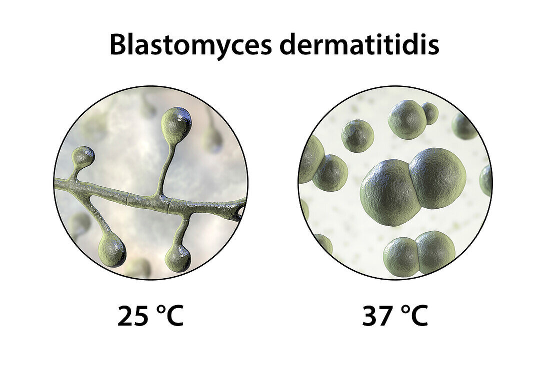 Blastomyces fungus, illustration