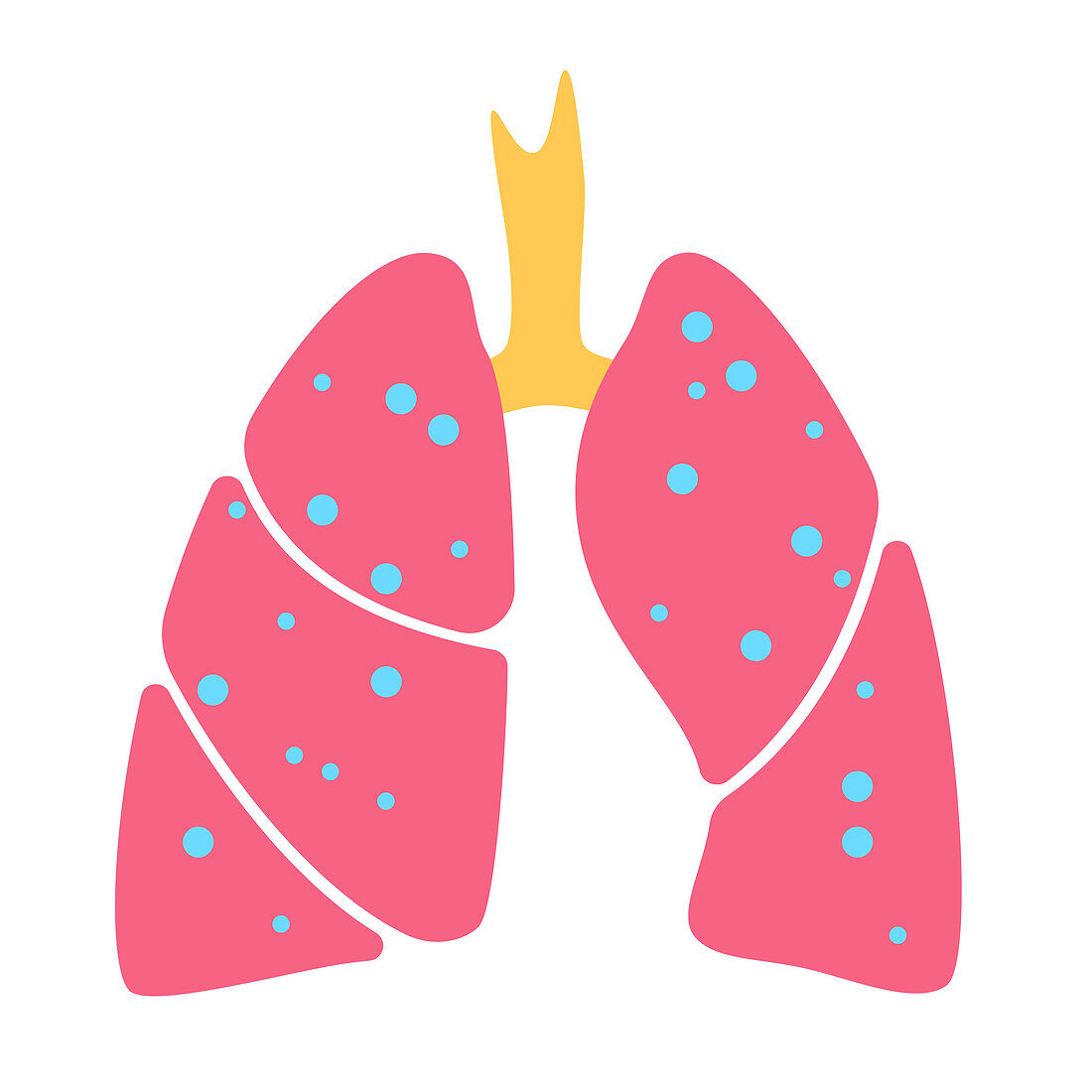 Lung disease, conceptual illustration