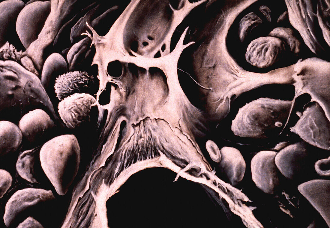 Bone marrow, illustration