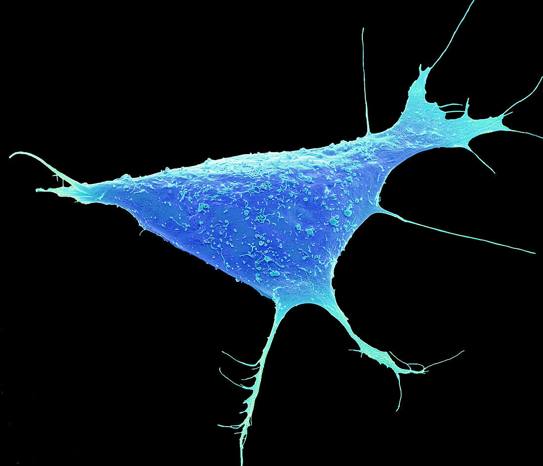 Human induced pluripotent cell