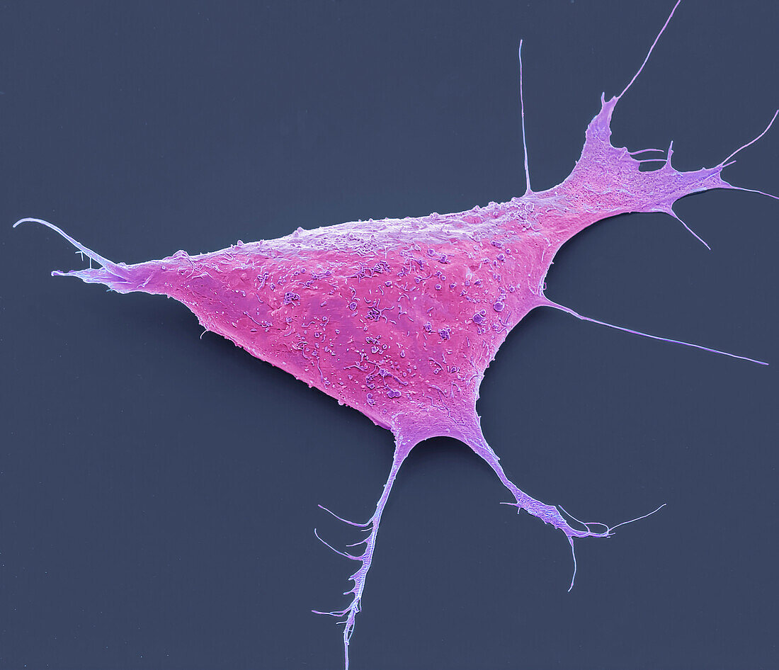 Human induced pluripotent cell, SEM