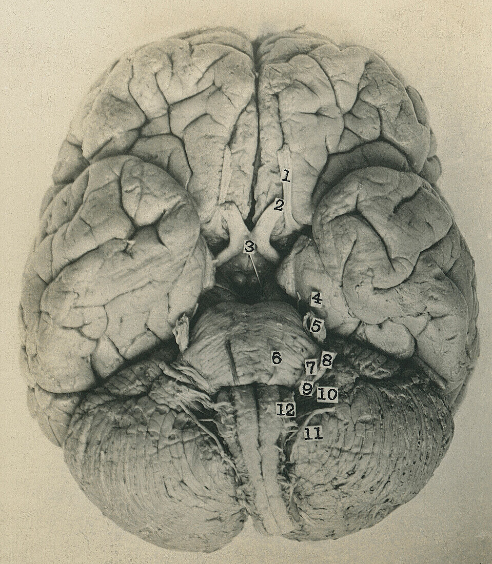 Base of the brain