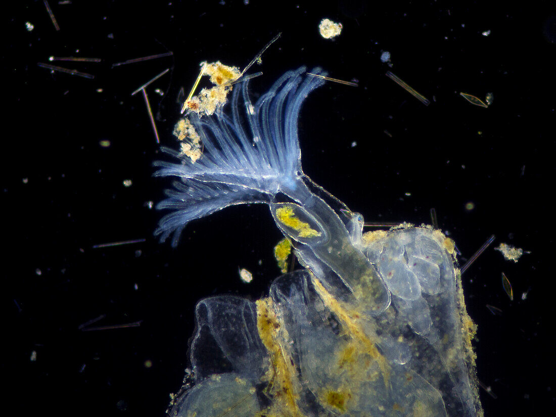 Bryozoan, light micrograph