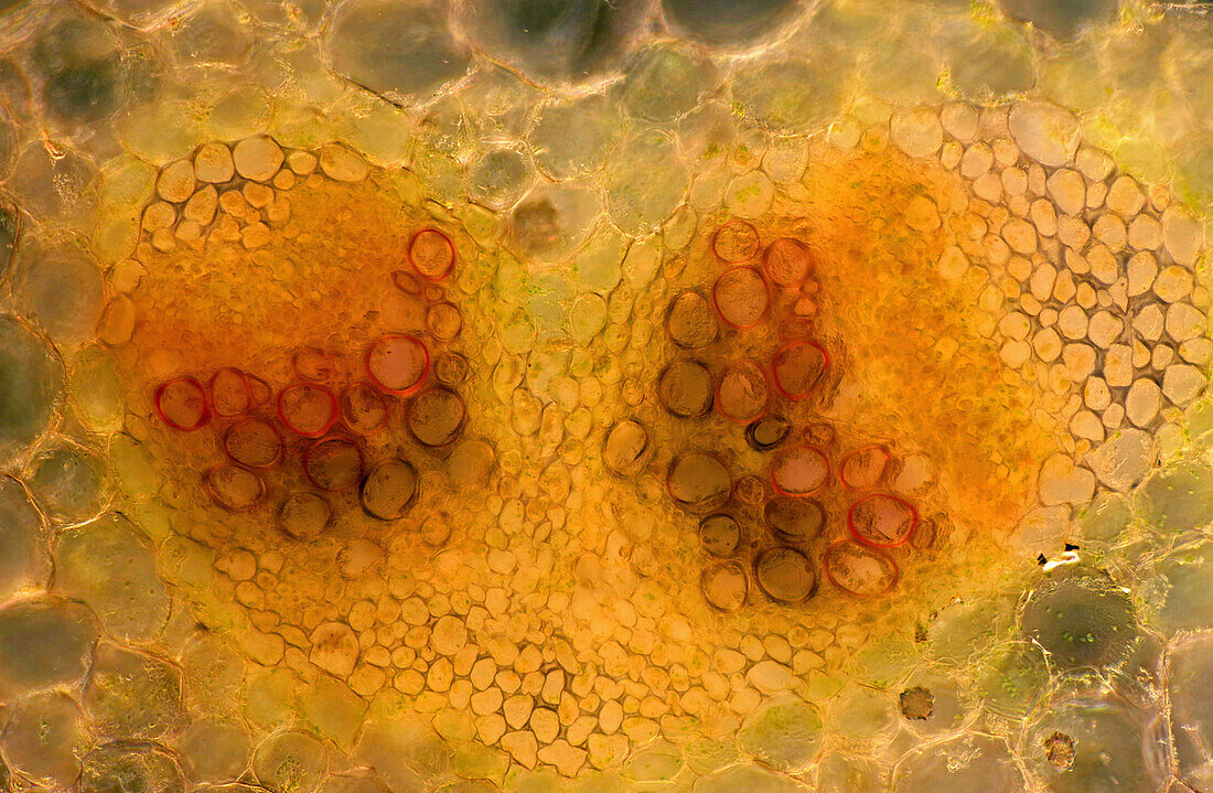 Garden rhubarb vascular bundles, light micrograph