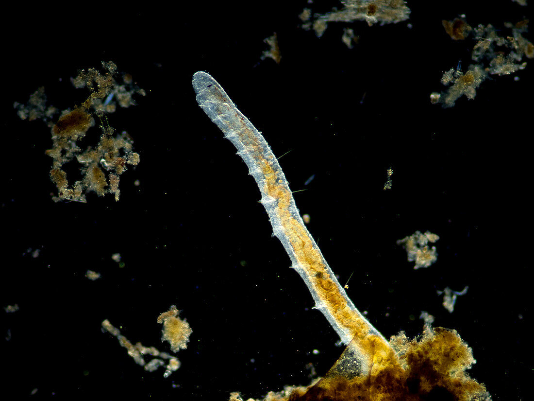 Freshwater annelid, light micrograph