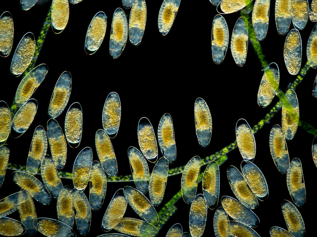 Midge eggs, light micrograph