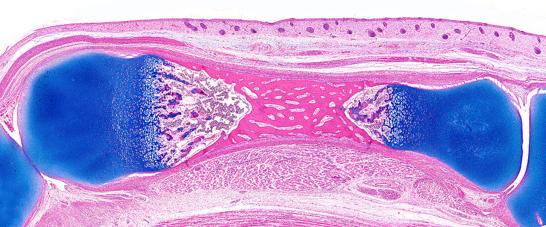 Growing bone, light micrograph