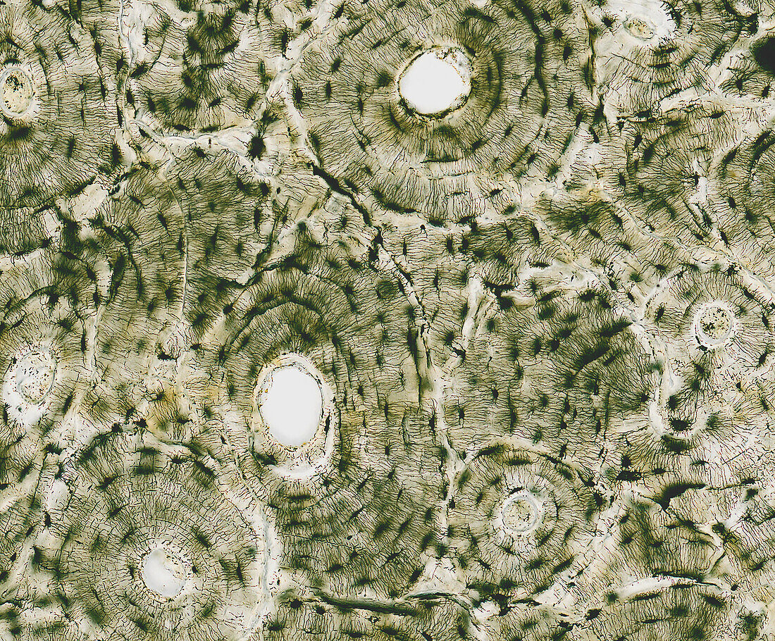 Bone tissue, light micrograph