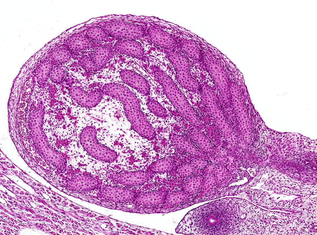 Foetal testis, light micrograph