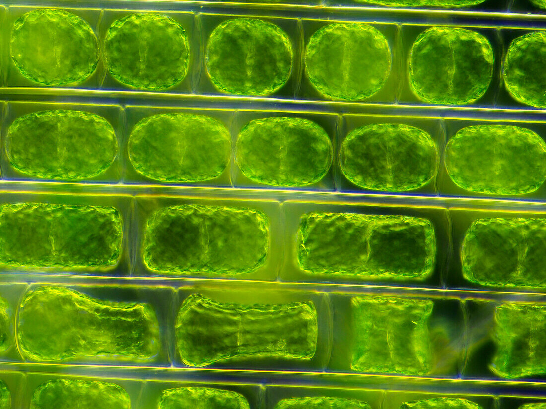 Filamentous conjugate algae, light micrograph