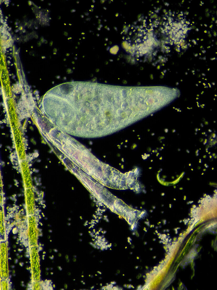 Stentor coeruleus, light micrograph