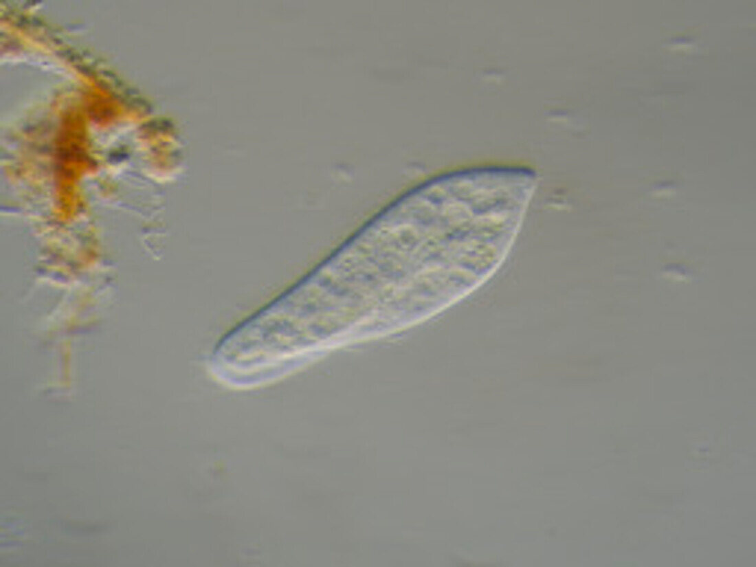 Paramecium, light micrograph