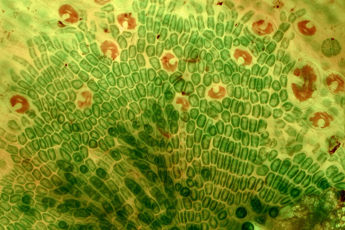 Green algae and Cocconeis sp. diatoms, light micrograph